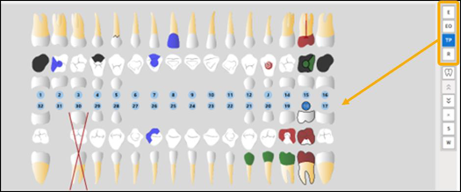 Odontogram with a procedure type selected showing a yellow highlight box around it as well as a yellow arrow pointing to the teeth affected.